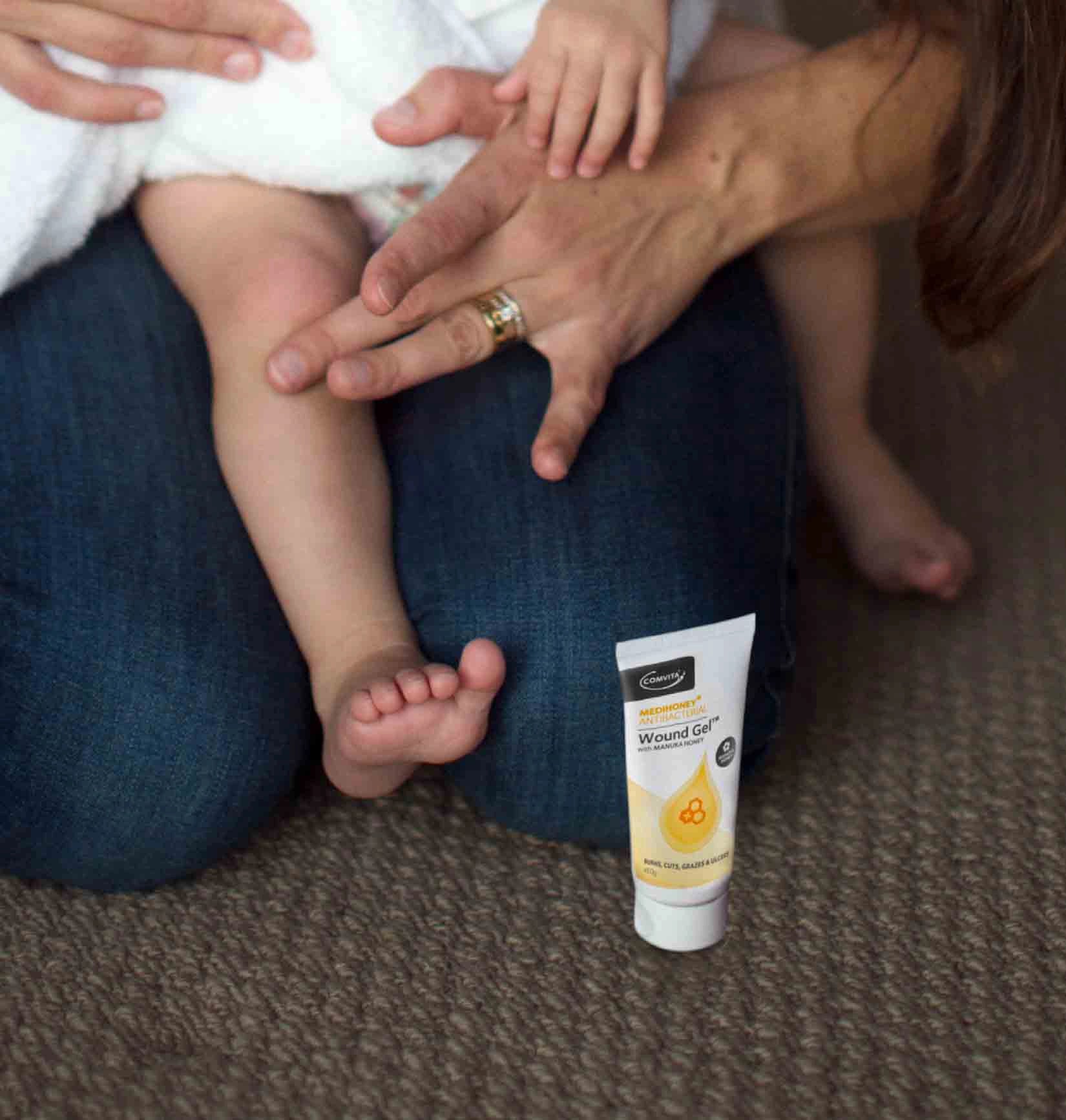 mum putting woundgel on child's knee